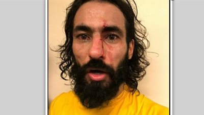 مشاجرة دامية في الدوري السعودي وتركي آل الشيخ يتدخل (فيديو)