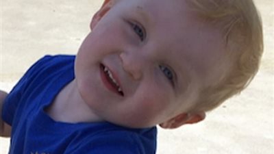 سيدة تفاجأ بنمو أسنان طفلها مثل «دراكولا» (صور)