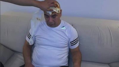 حسام حسن يتصدر «تويتر» بعد إصابتة بـ«طوبة» من جماهير فيتا كلوب