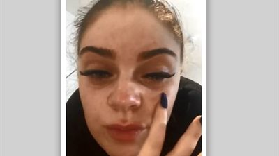 فتاة تفقد بصرها ساعتين بسبب الرموش الصناعية (صور)