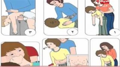 بالفيديو.. الإسعافات الأولية عند ابتلاع طفلك لجسم غريب