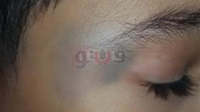 أولياء أمور طلاب الخصوص يطالبون بحظر لعبة البندول في المدارس