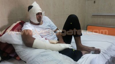 بالصور.. فرد الأمن المُعتدى عليه بجامعة الأزهر: ما حدث لن يمنعني عن عملي