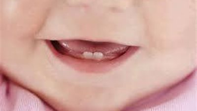 السخونة والإسهال الخفيف من أعراض التسنين على طفلك الرضيع