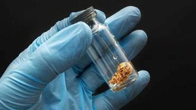 «استشاري» يوضح إجراءات الحفاظ على الخصوبة بتجميد البويضات