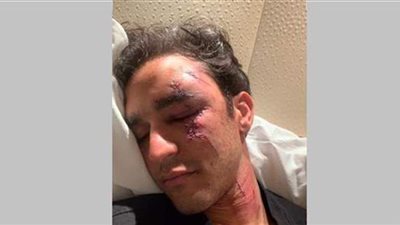 حادث سير لزيادة نجم منتخب الفروسية في سويسرا