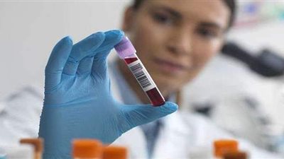 مفاجأة.. أصحاب فصيلة الدم A أقل عرضة لأمراض القلب