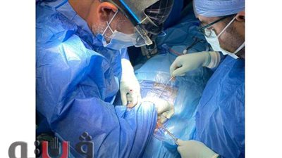 نجاح جراحة نادرة بالمستشفى التعليمى بطنطا: لأول مرة.. تركيب مفصل صناعي بالرقبة لمريضة