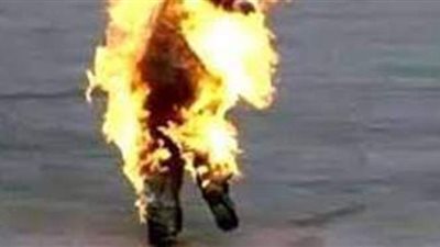 اعتراضا على غلق الورشة.. ميكانيكي ومساعده يشعلان النيران في جسديهما بالشيخ زايد