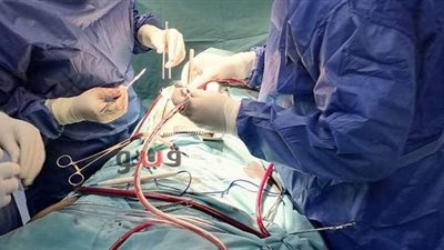 إجراء جراحة قلب مفتوح لطفلة عمرها 6 سنوات بمستشفى المنصورة الدولي