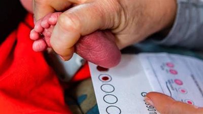 ما هو مرض pku الذي يصيب الرضع وما أعراضه؟