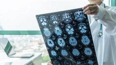 تفاصيل جلطة دماغية تصيب سيدة خلال اجتماع على 