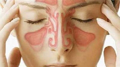 أعراض التهاب الجيوب الأنفية وطرق العلاج الطبيعية