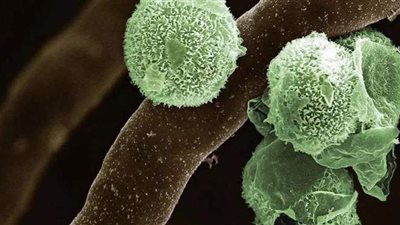 بعد الأسود والأبيض والأصفر.. تعرف على أسباب واعراض الفطر الأخضر