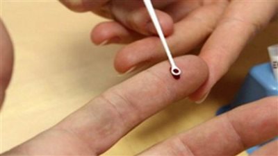 أعراض فيروس C وأسباب الإصابة به