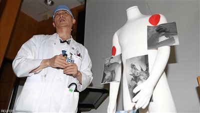 بالصور.. العثور على طفيليات طولها 27 سنتيمتر داخل أمعاء جندي كوري