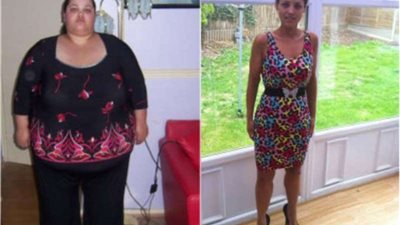 استشاري سمنة: الاعتماد على الأغذية الطبيعية أفضل طريقة لخسارة الوزن