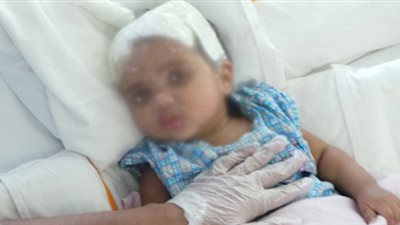 نقل الرضيعة المصابة بنزيف على يد والدها بالدقهلية للعناية المركزة