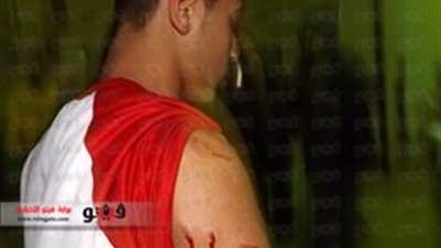 بالصور.. ننشر أسماء المصابين في اشتباكات كفر الدوار بحروق وطلق ناري