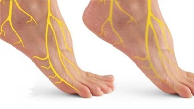 8 نصائح تساعد في التهاب الأعصاب الطرفية