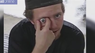 رجل يخرج مقلة عينه بيده العارية (فيديو صور)