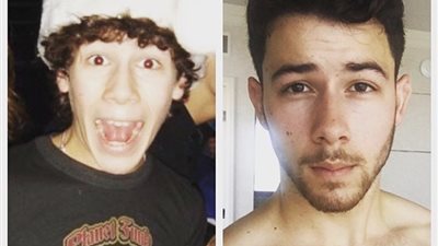 نيك جوناس يصف شعوره بعد تشخيصه بمرض السكري