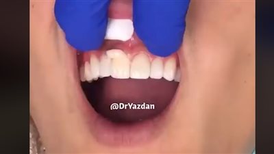 طبيب أسنان يغير حياة الأشخاص بتغيير ابتسامتهم (فيديو)