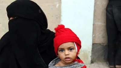 الجارديان: وفاة أكثر من مليون طفل يمني
