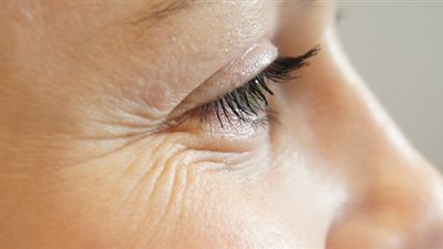 ثلاثة أقنعة طبيعية لإزالة آثار تجاعيد العينين