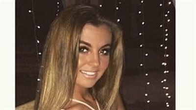 كريم تسمير البشرة يشوه وجه فتاة (صور)