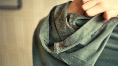 اكتشاف مادة كيميائية تقف وراء الرغبة في حك الجلد