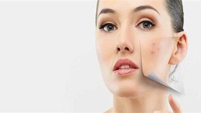 وصفات طبيعية لتفتيح البشرة والأماكن الداكنة بالجسم