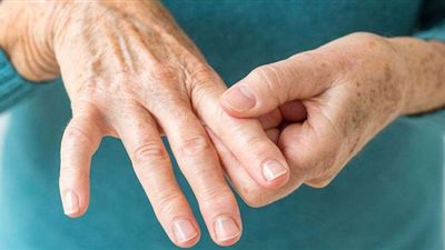 يسبب الإعاقة لكبار السن.. تعرف على أعراض مرض التهاب المفاصل