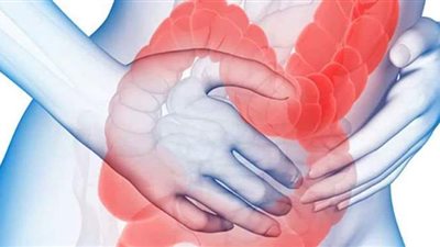 أعراض قرحة القولون وطرق العلاج