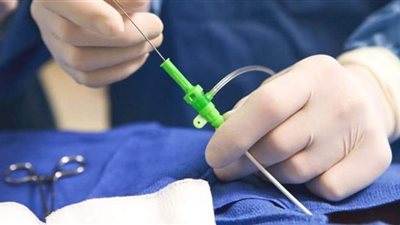 اجراء 511 قسطرة قلبية بمستشفى الزقازيق فى الشرقية