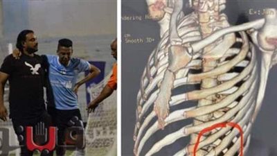 الأشعة تؤكد إصابته بكسر في الضلوع.. غياب يحيى حامد شهرا عن غزل المحلة