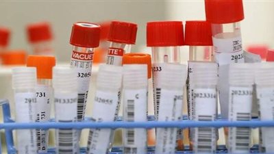 لها تجربة سابقة.. مختبرات سويسرية تطلق نوعا مبتكرا من فحوصات كورونا لكشف سلالة دلتا