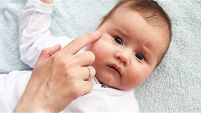 أعراض الجفاف عند الرضع