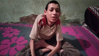 مبادرة علاج ضمور العضلات في عيون المرضى بالفيوم