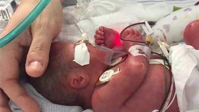 بالفيديو والصور.. لحظات مؤثرة لأب يغني لطفله الرضيع أثناء احتضاره