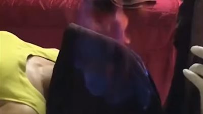 أغرب علاج للجسد والوجه في فيتنام بالمناشف المشتعلة (فيديو)