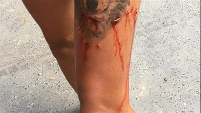 مشهد مروع لتمساح يعض فتاة تسير على خليج (فيديو)