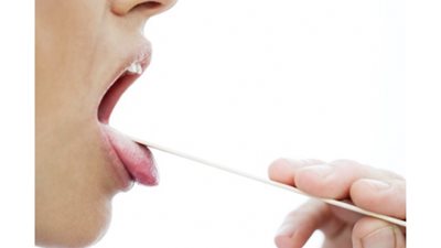 ما هي أسباب الإصابة بحرقان الفم واللسان