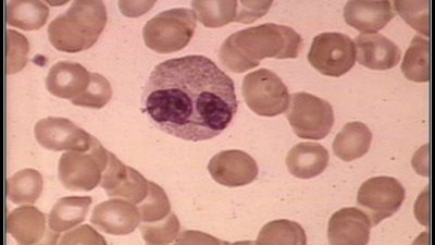 طالب يبتكر جهازا لقتل البكتيريا عن طريق الصعق بالكهرباء