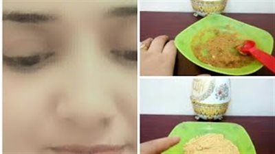 وصفة طبيعية للتخلص من حب الشباب في 30 دقيقة