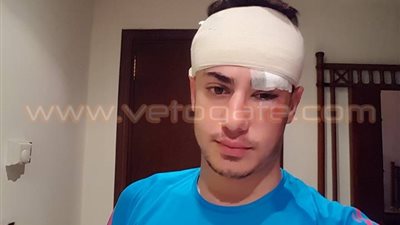 بالصور.. 4 غرز لمحمود حمدي لاعب المنتخب الأوليمبي في مباراة الكاميرون