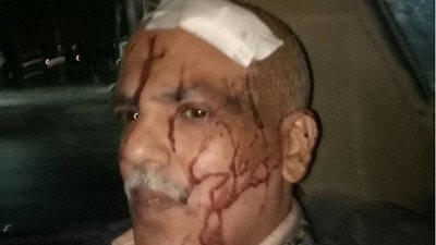 معلم يعتدي على مدير مدرسة بـ«الشاكوش» في الغربية