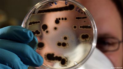 أنواع البكتيريا وأعدادها ترتبط بحجم الغرف وطريقة تهويتها