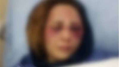 «خلخال على واتس».. تفاصيل تعذيب عامل لزوجته لشكه في سلوكها (صور)