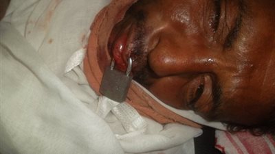 بالمستندات.. مجلس إسنا: المواطن الذي أغلق فمه بالقفل مسجل خطر